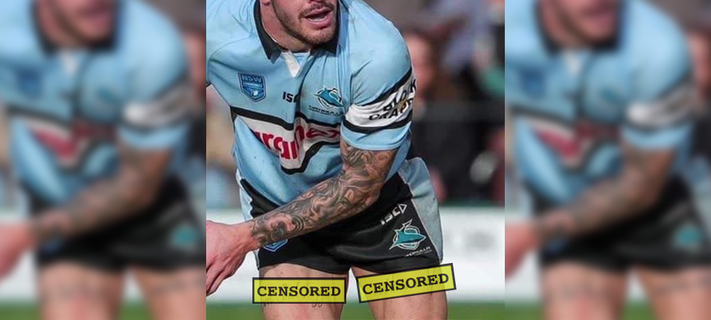 Rugby League Threatens Ban For Player With Homophobic Slur Tattoo